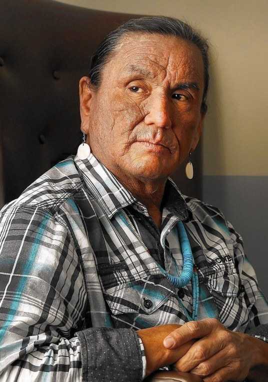 �Ű��������¸�������