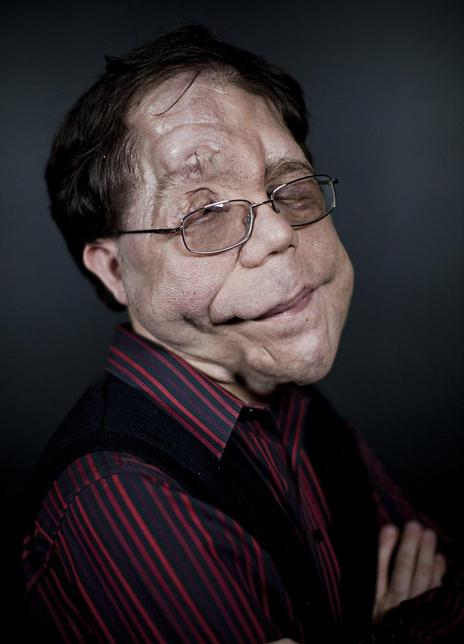 �ǵ���Ƥ��ɭ��������